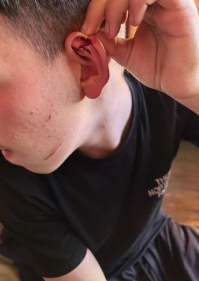 Жестоко нападение в Костинброд: 13-годишно дете е бито и заплашено с нож